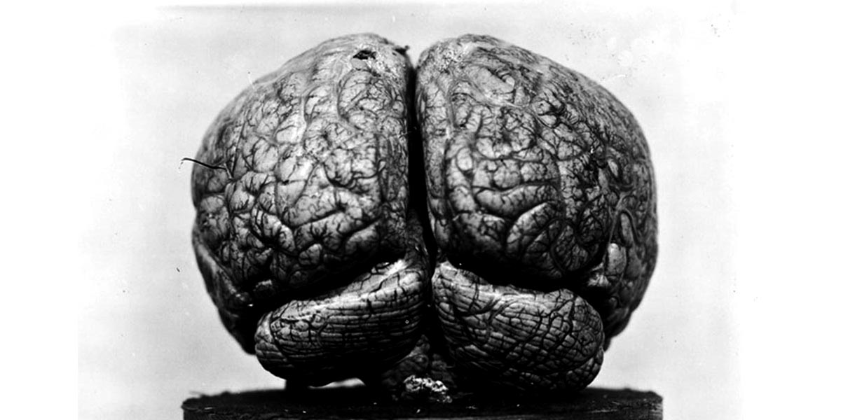 10 bin fotoğraf, 500 beyin: Dr. Harvey Cushing