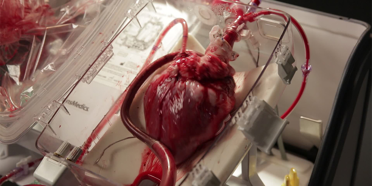 Bu cihazla vücudun dışında atmaya devam eden kalp nakledilebiliyor