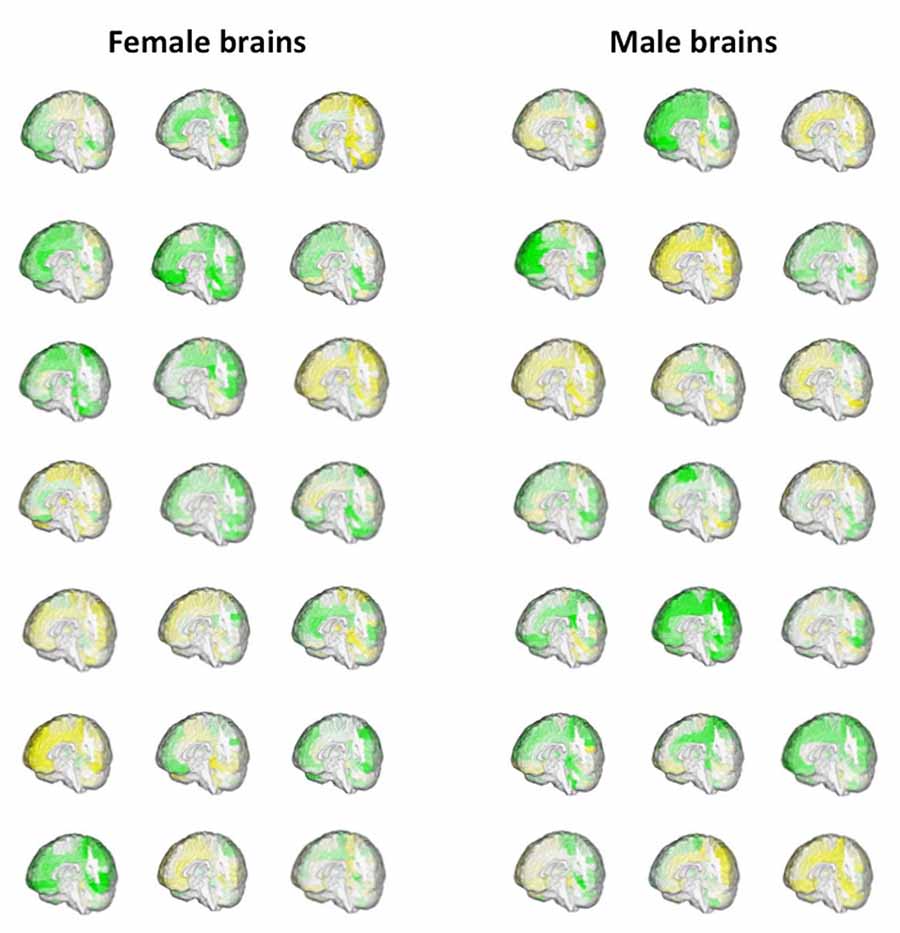 Erkek beyin, dişi beyin 2