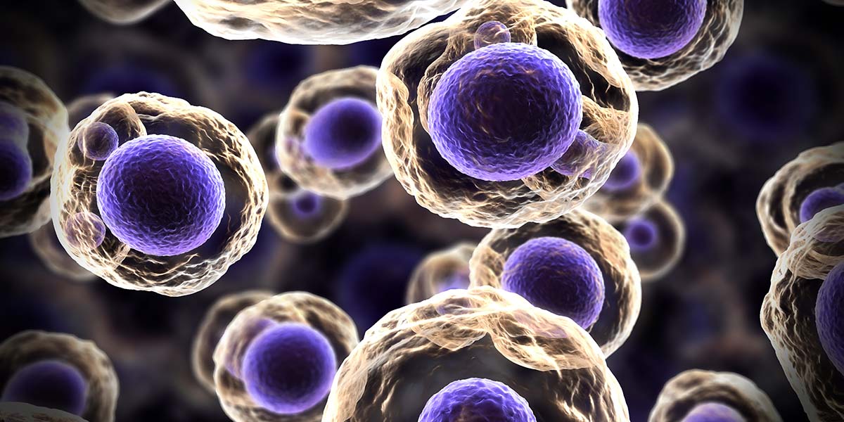 Tıpçı yatar, fizikçi yapar: Kanserli hücrelerin sesini duyan mikroskop